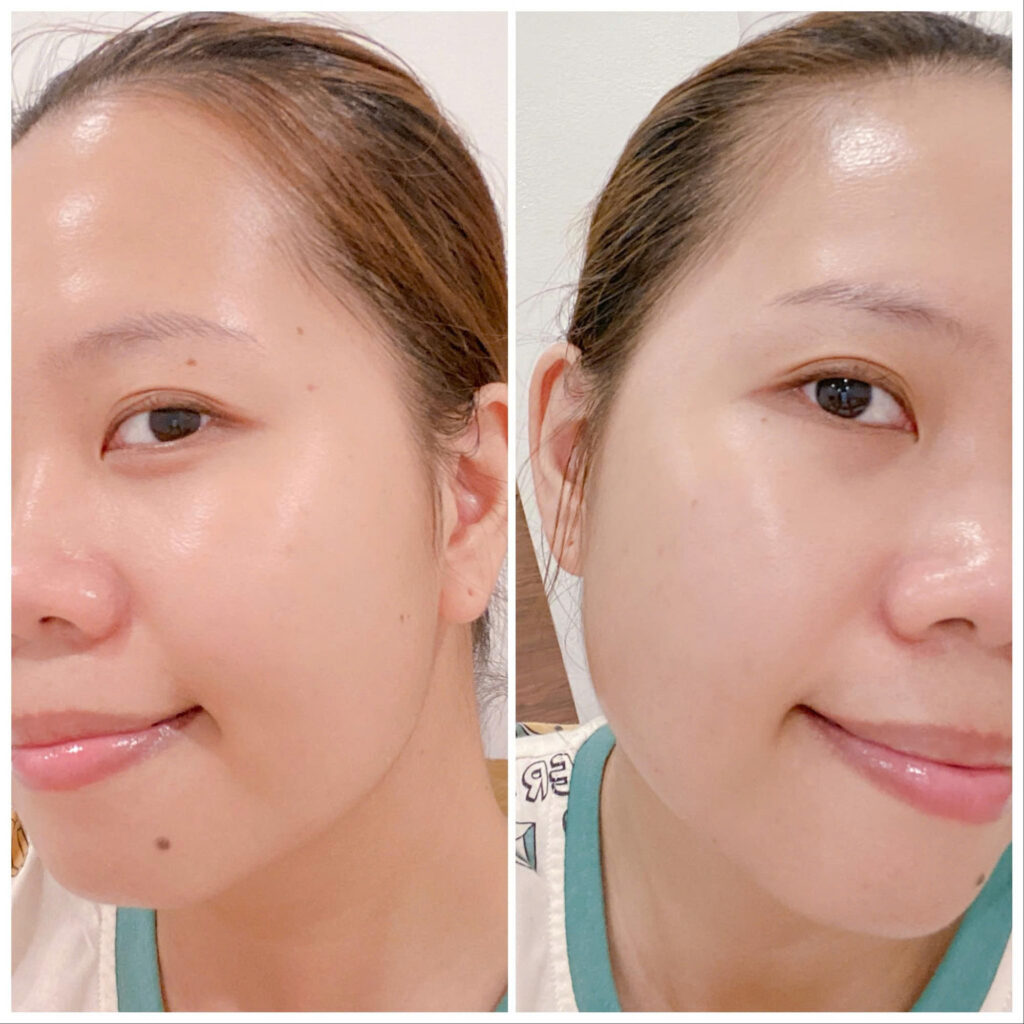 TRUOC-VA-SAU-KHI-SU-DUNG-NUOC-UONG-COLLAGEN